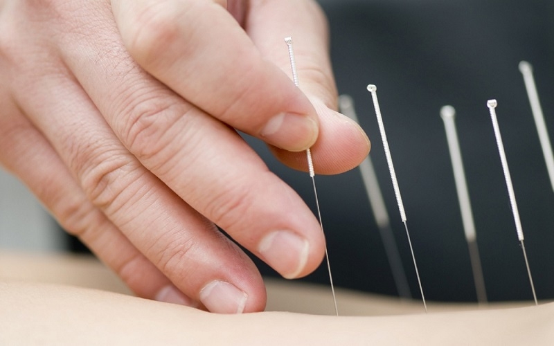 How does acupuncture work?