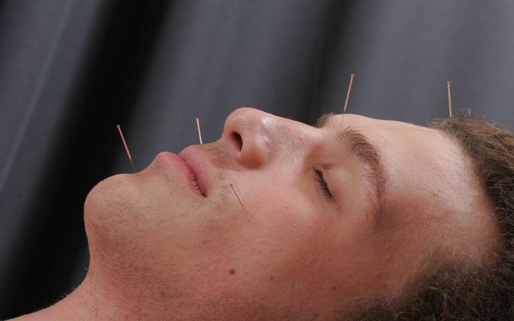 Acupuncture And The Treatment Of Insomnia