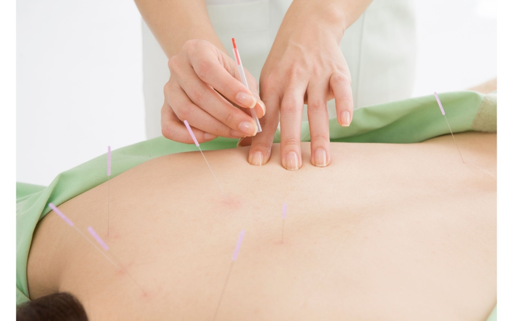 Why acupuncture