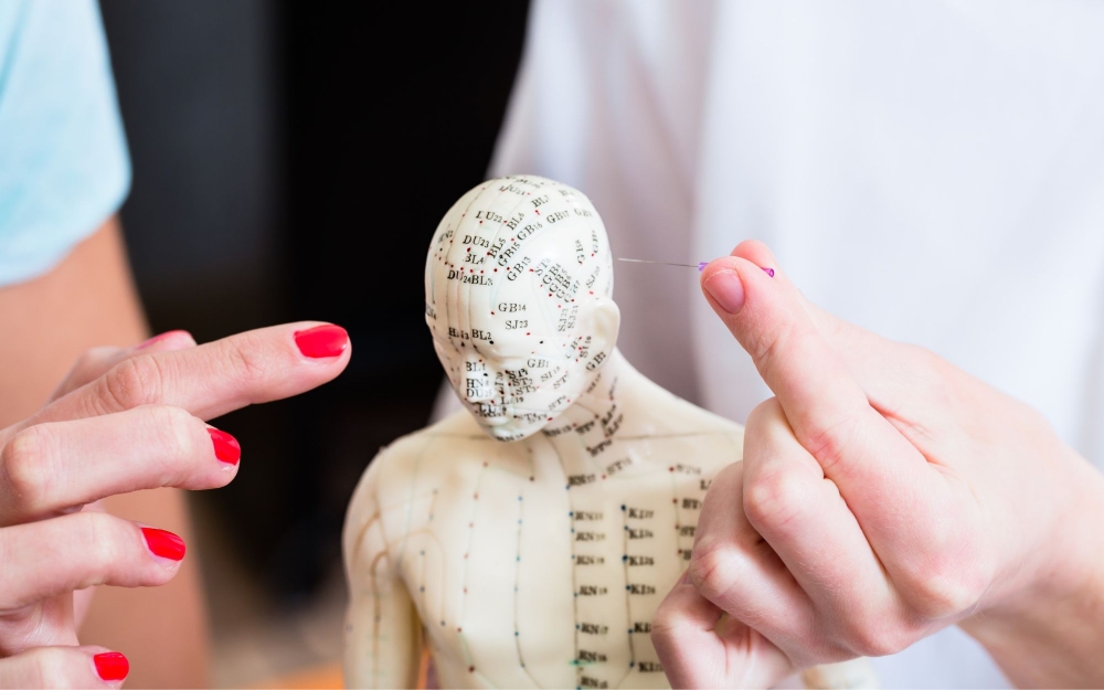 Areas of Acupuncture